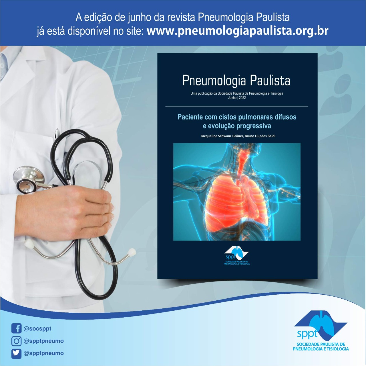 No momento, você está visualizando Revista Pneumologia Paulista – Paciente com cistos pulmonares difusos e evolução progressiva